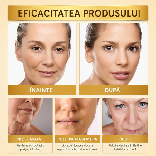 1+1 GRATIS Cremă cu Venin de Albine – Tratament Anti-Îmbătrânire pentru Față și Ochi, Efect de Fermitate și Reducere a Ridurilor